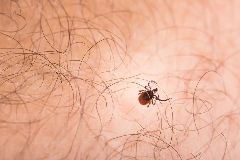 engorged tick crawling on skin with hair follicles 2026 03 05 11 32 52 utc